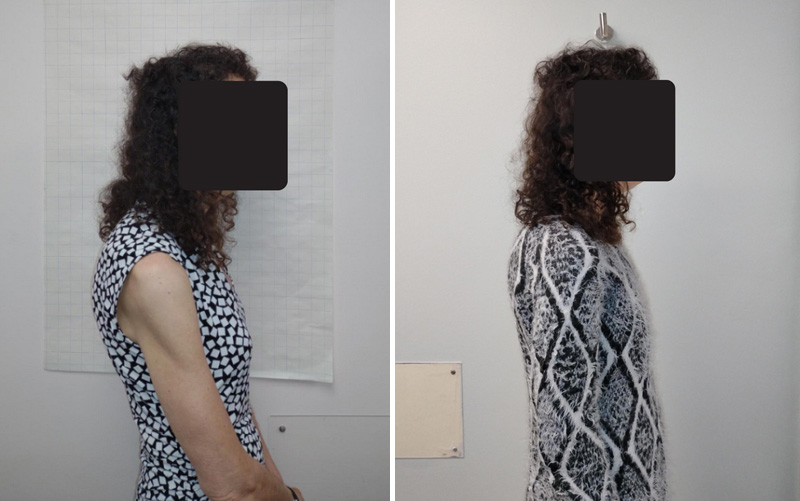 Whole Body Orthodontics is the Best Orthodontics Waltham