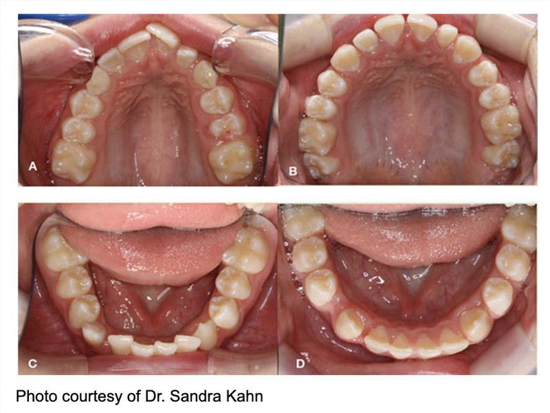 Functional Orthodontics Waltham