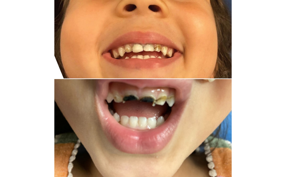Pediatric Dentistry Waltham